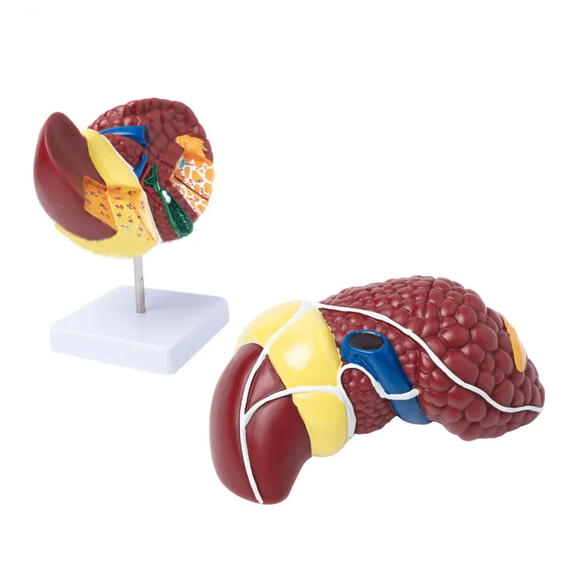 1:1 Human Pathological Liver Anatomical Model Display Of Digestive System Anatomy Teaching Model - Image 2