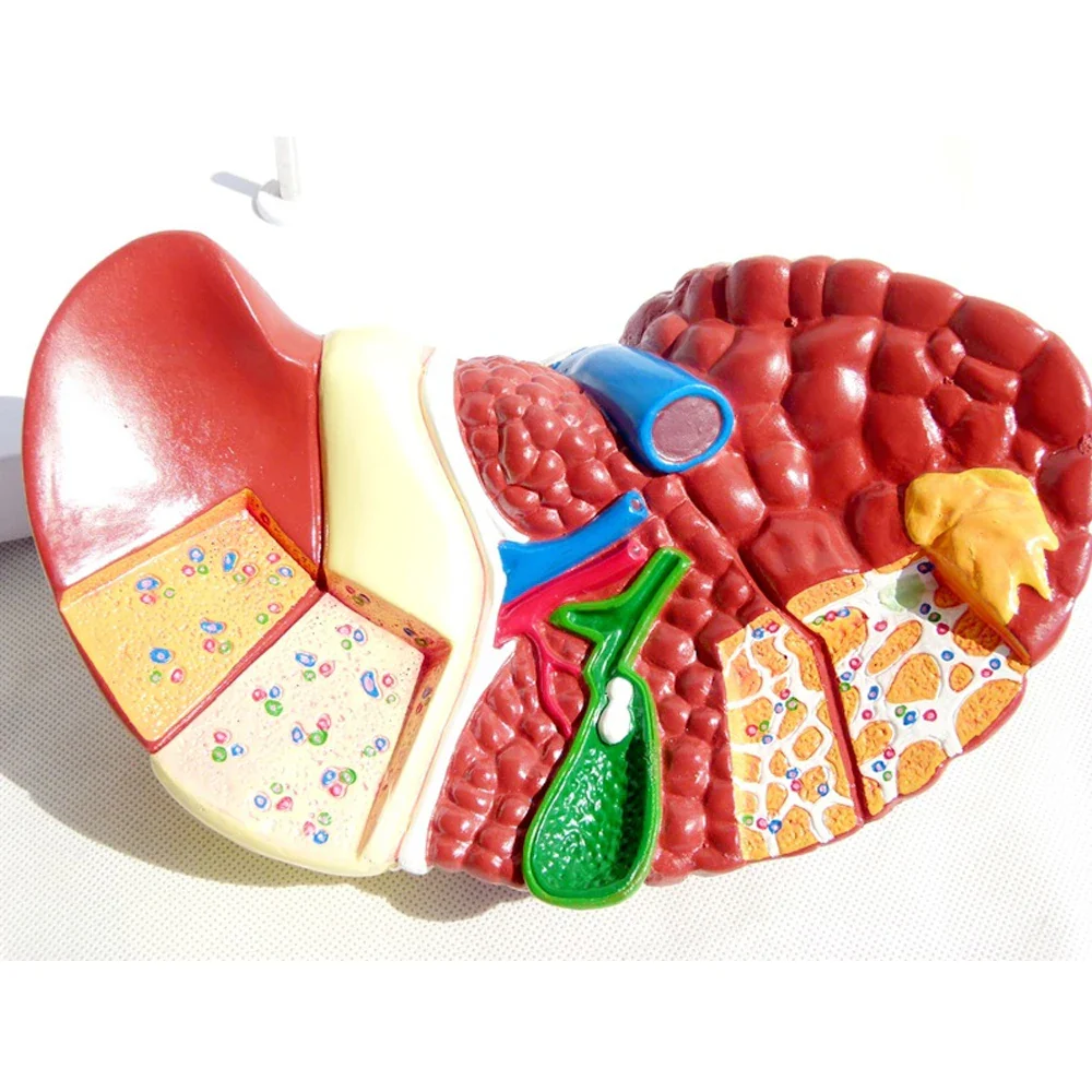1:1 Human Pathological Liver Anatomical Model Display Of Digestive System Anatomy Teaching Model - Image 6