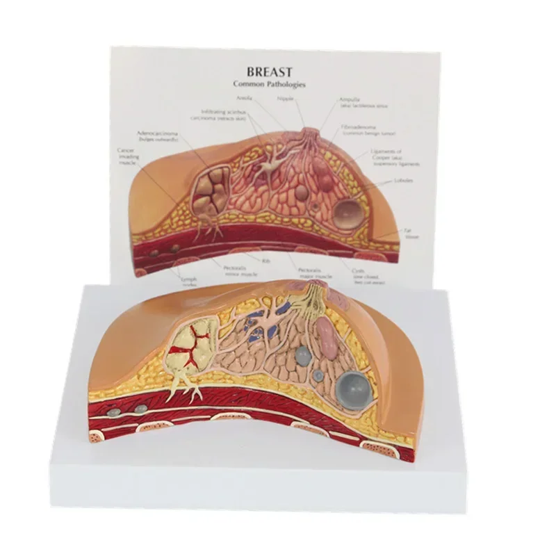 1:1 Median Section Model of Human Female Breast Pathology Anatomy Model Kit Table-type breast lesion model lactating breasts