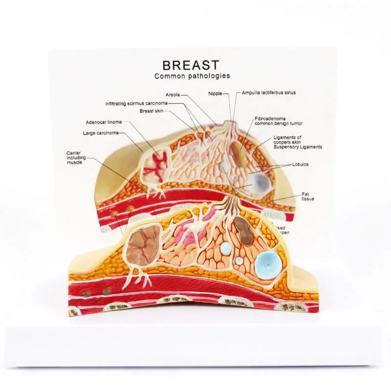 1:1 Median Section Model of Human Female Breast Pathology Anatomy Model Kit Table-type breast lesion model lactating breasts - Image 2
