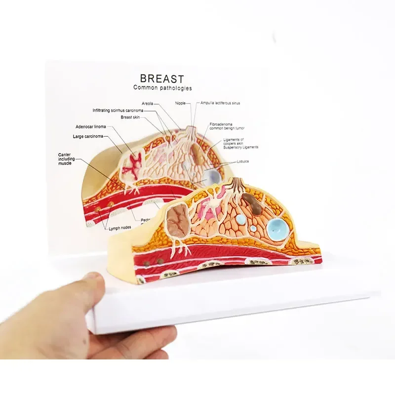 1:1 Median Section Model of Human Female Breast Pathology Anatomy Model Kit Table-type breast lesion model lactating breasts - Image 3