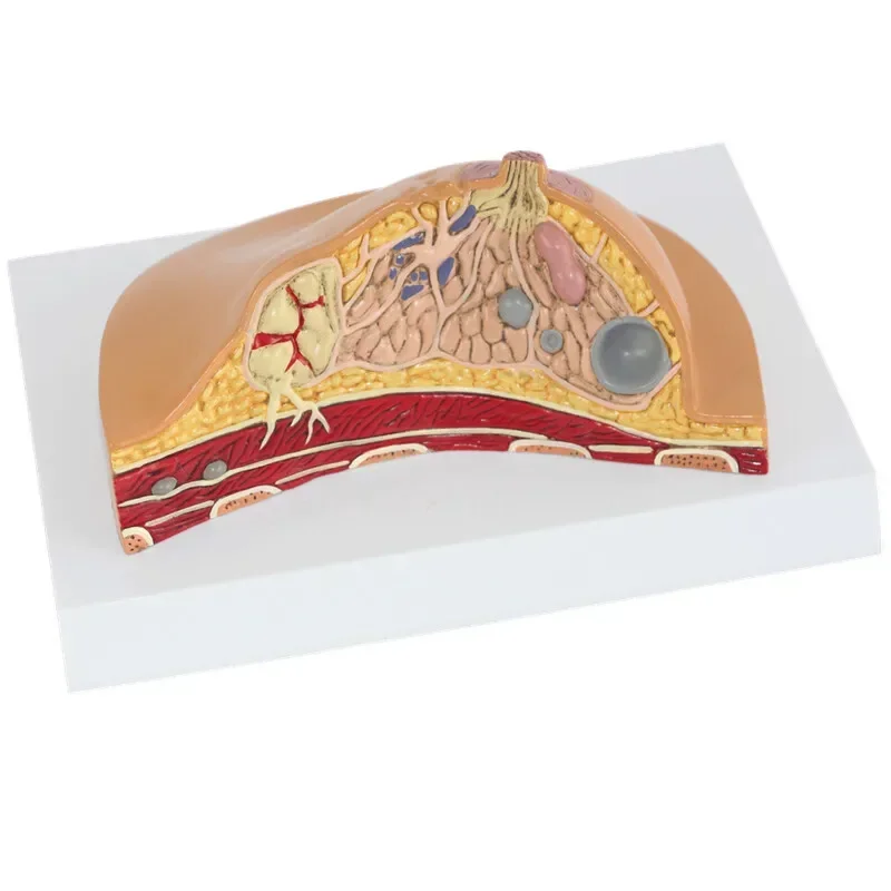 1:1 Median Section Model of Human Female Breast Pathology Anatomy Model Kit Table-type breast lesion model lactating breasts - Image 4