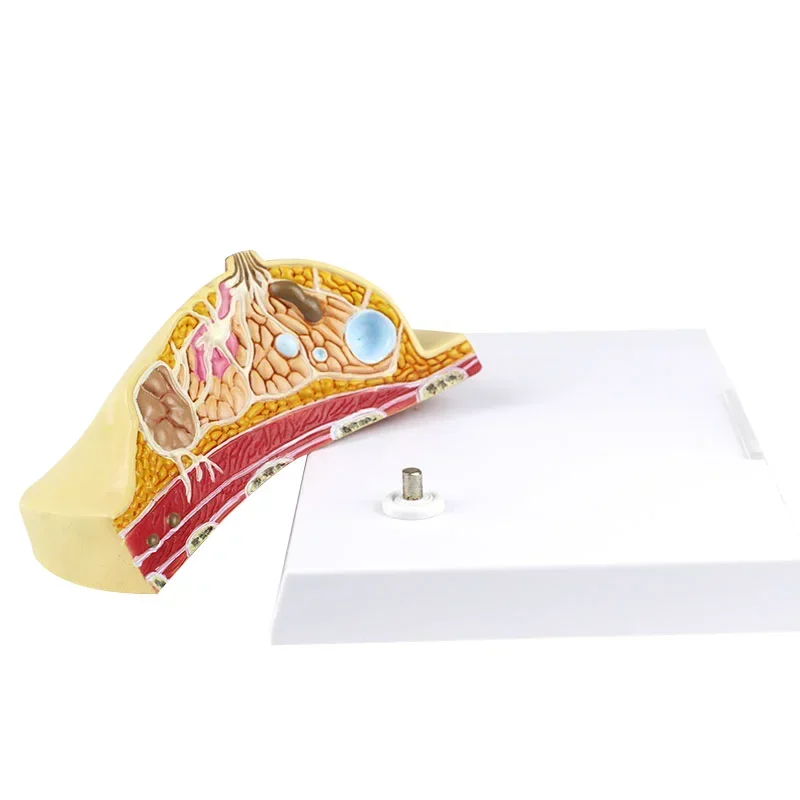 1:1 Median Section Model of Human Female Breast Pathology Anatomy Model Kit Table-type breast lesion model lactating breasts - Image 5