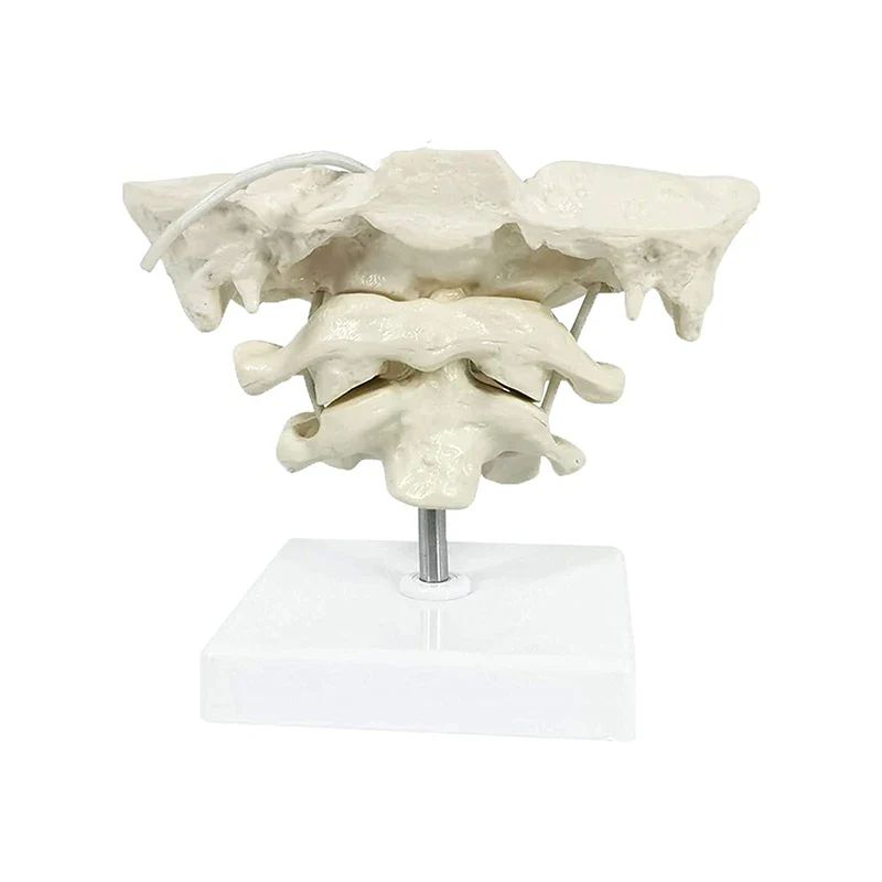 1.5x Magnification Human Cervical Spine Model Occipital Bone Model Medical Teaching Training Aid