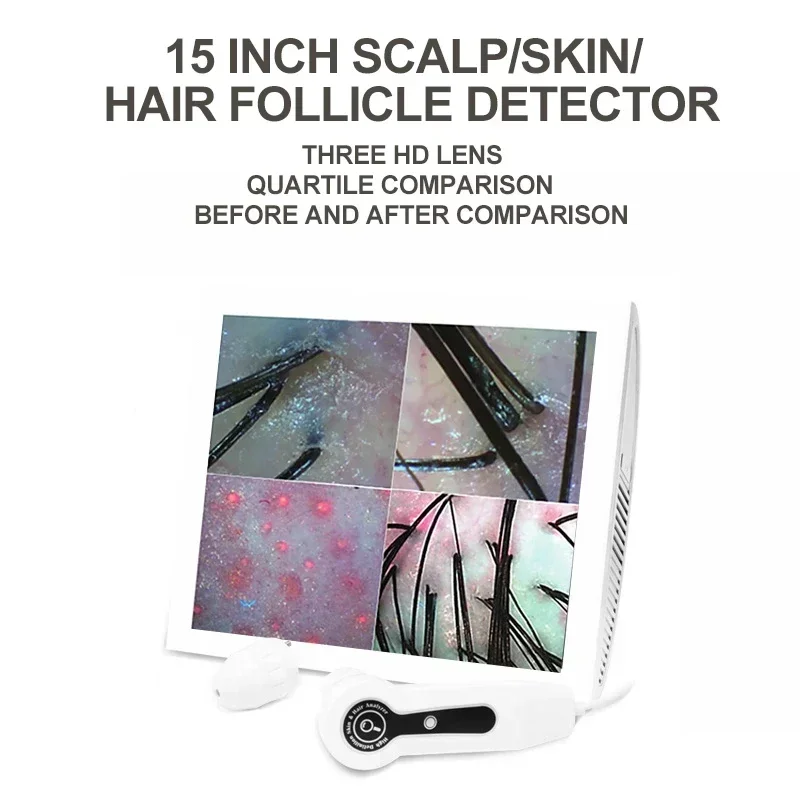 HD Digital Skin Analyzer Professional Hair Scalp Camera Detector Hair Follicle Oil Moisture Test Device 15inch Skin Tester - Image 4