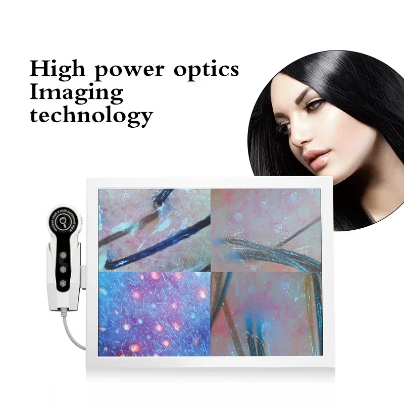 HD Digital Skin Analyzer Professional Hair Scalp Camera Detector Hair Follicle Oil Moisture Test Device 15inch Skin Tester - Image 5