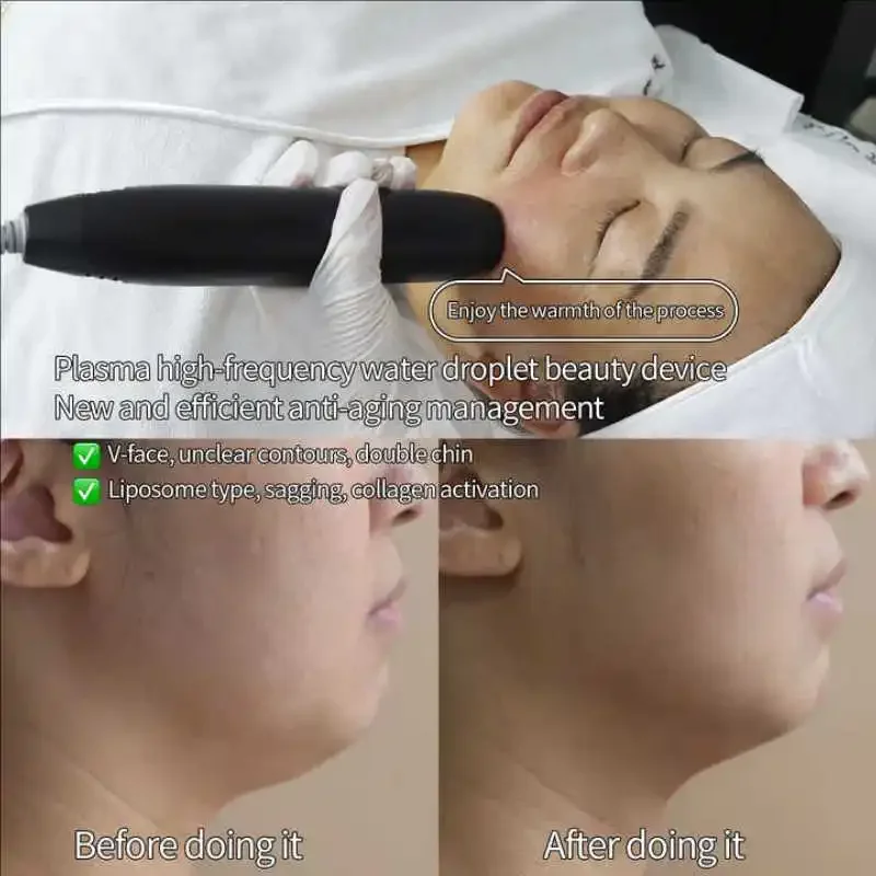 Newest Arrival 3 in 1 Cold Plasma High Frequency Vibration Vacuum Skin Tightening Wrinkle Remover Beauty Machine - Image 4