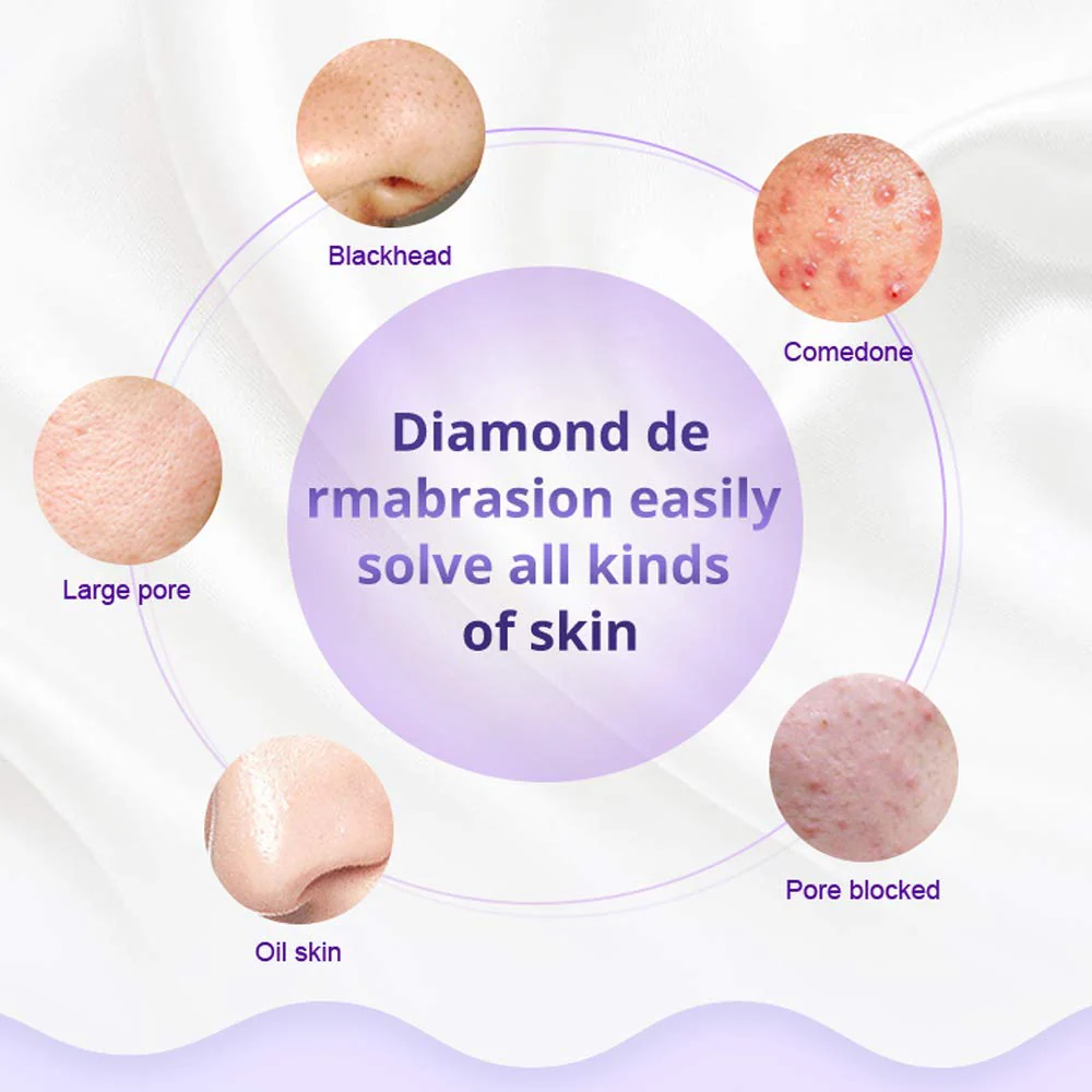 3 in 1 Diamond Microdermabrasion Dermabrasion Blackhead Removal Machine w/Vacuum & Spray for Skin Care Home Use Device - Image 4
