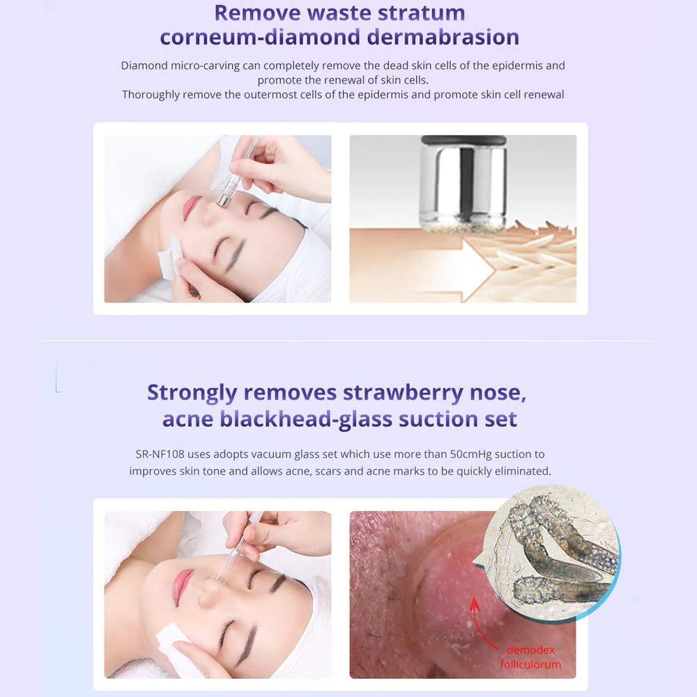 3 in 1 Diamond Microdermabrasion Dermabrasion Blackhead Removal Machine w/Vacuum & Spray for Skin Care Home Use Device - Image 5
