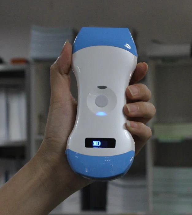 3 in 1 Wireless Ultrasound Probe Ultrasound Scanner with WIFI Support for iOS, Android, Convex, Linear, and Phased Array Scanning - Image 4