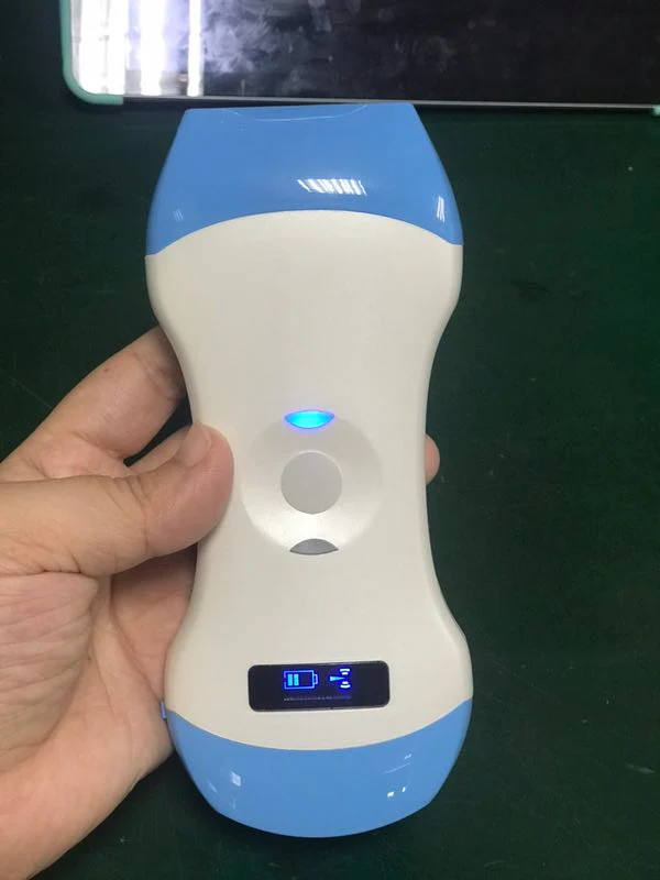 3 in 1 Wireless Ultrasound Probe Ultrasound Scanner with WIFI Support for iOS, Android, Convex, Linear, and Phased Array Scanning - Image 5