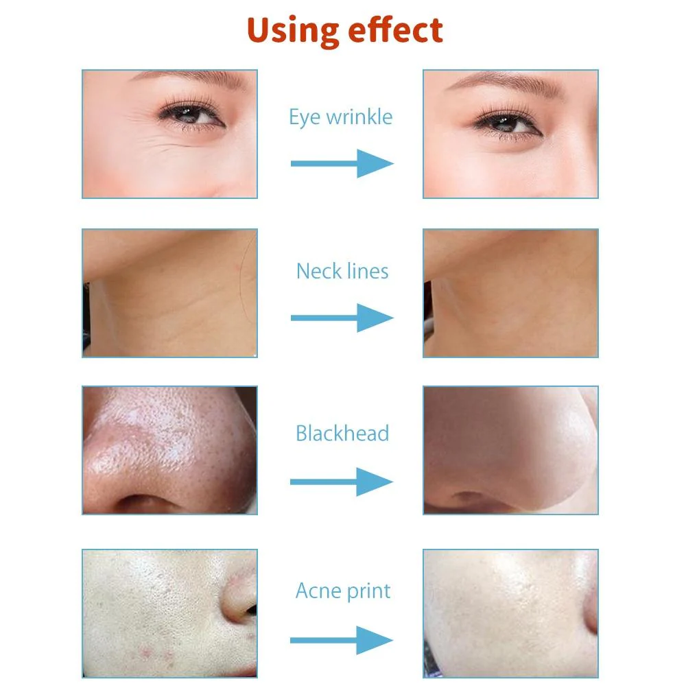 3 in 1 Diamond Microdermabrasion Peel Machine Water Spray Exfoliation Dermabrasion Machine Removal Wrinkle Facial Peeling For SPA - Image 9