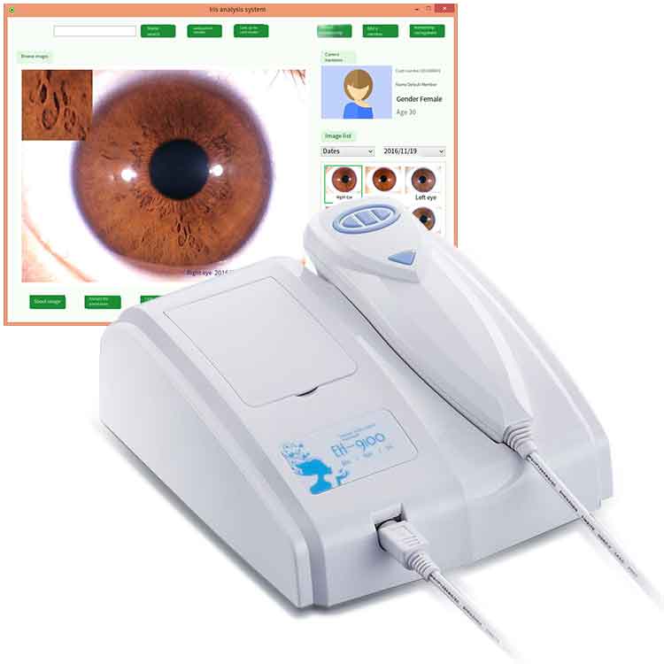 Digital Iridology Analyzer 5MP USB Eye Iridoscope Iridology Camera Analyzer Disease Diagnosis Machine Body Analyser Machine - Image 3