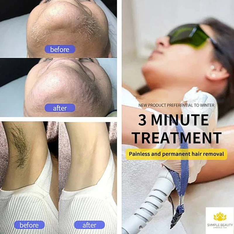 Alma Titanium 3200W 755nm 808nm 1064nm Ice Hair Removal Removal Skin Rejuvenation Face Lifting Skin Whitening Machine - Image 6