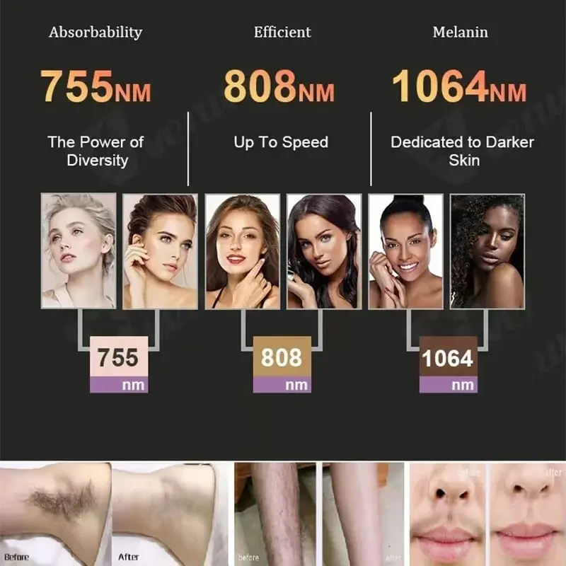 Alma Titanium 3200W 755nm 808nm 1064nm Ice Hair Removal Removal Skin Rejuvenation Face Lifting Skin Whitening Machine - Image 8