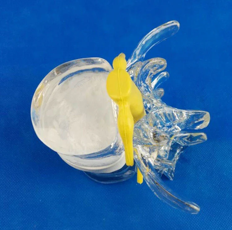 Anatomical Human Lumbar Vertebrae Skeleton Anatomy Degenerative Lumbar Disc Herniation Demonstration Model Spine Medical Aids - Image 2