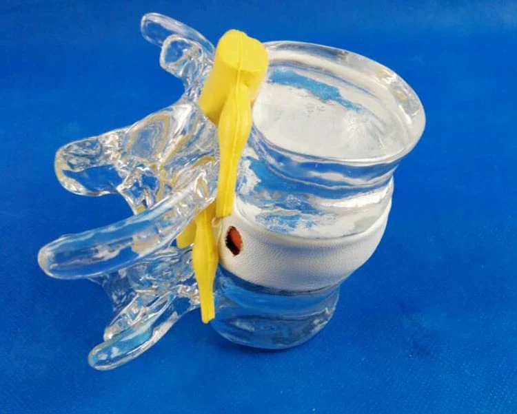 Anatomical Human Lumbar Vertebrae Skeleton Anatomy Degenerative Lumbar Disc Herniation Demonstration Model Spine Medical Aids - Image 3