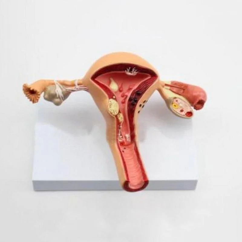 Anatomical Pathological Uterus Ovary Model Anatomy Medical Organ Model Cross Section Study Tool - Image 2