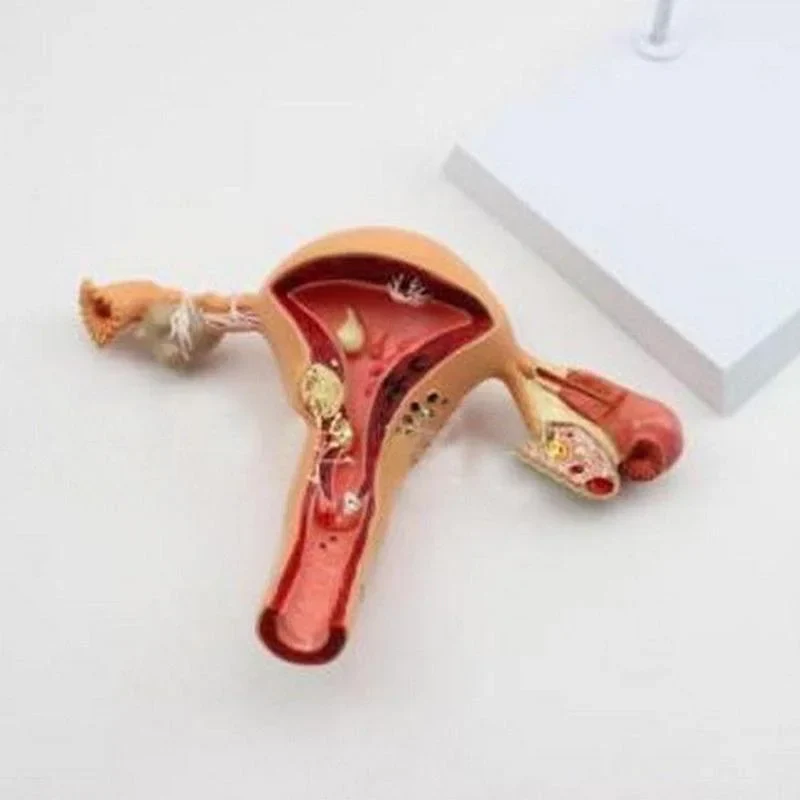 Anatomical Pathological Uterus Ovary Model Anatomy Medical Organ Model Cross Section Study Tool - Image 3