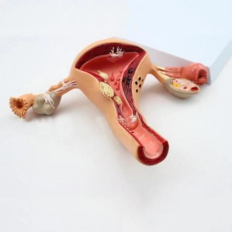 Anatomical Pathological Uterus Ovary Model Anatomy Medical Organ Model Cross Section Study Tool - Image 4