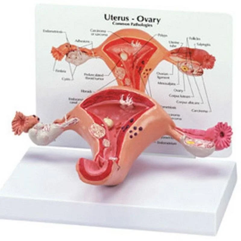 Anatomical Pathological Uterus Ovary Model Anatomy Medical Organ Model Cross Section Study Tool - Image 5