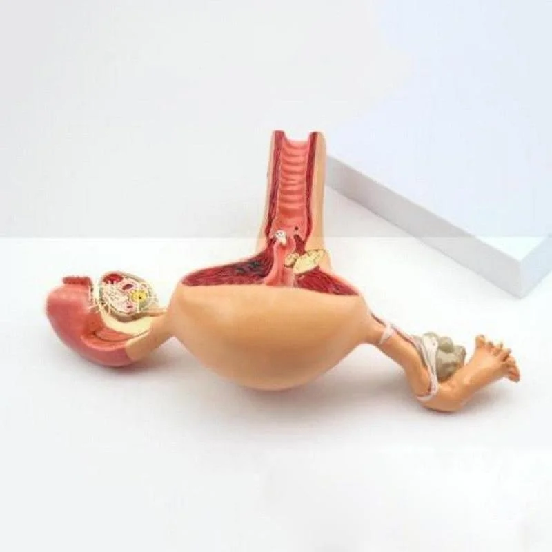 Anatomical Pathological Uterus Ovary Model Anatomy Medical Organ Model Cross Section Study Tool - Image 6