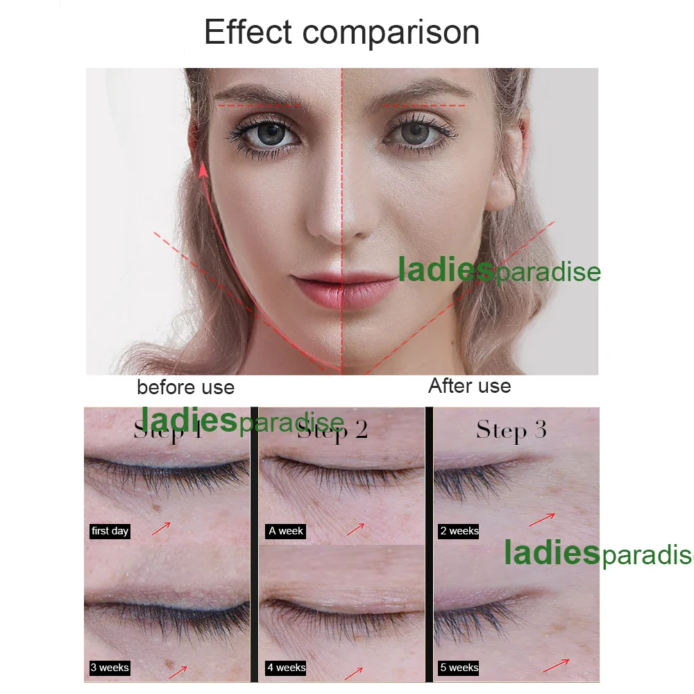 Anti Aging Microcurrent Ion Beauty Stimulator Face Lift Tighten Skin Rejuvenation Remove Wrinkle Galvanic Massager - Image 6