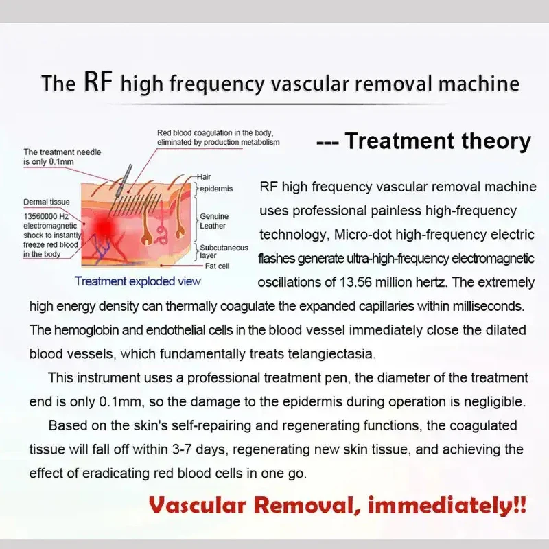Big Power 60w RF Red Blood Vessel Vascular Removal Beauty Equipment High Frequency Needle RF Spider Veins Removal Device - Image 3
