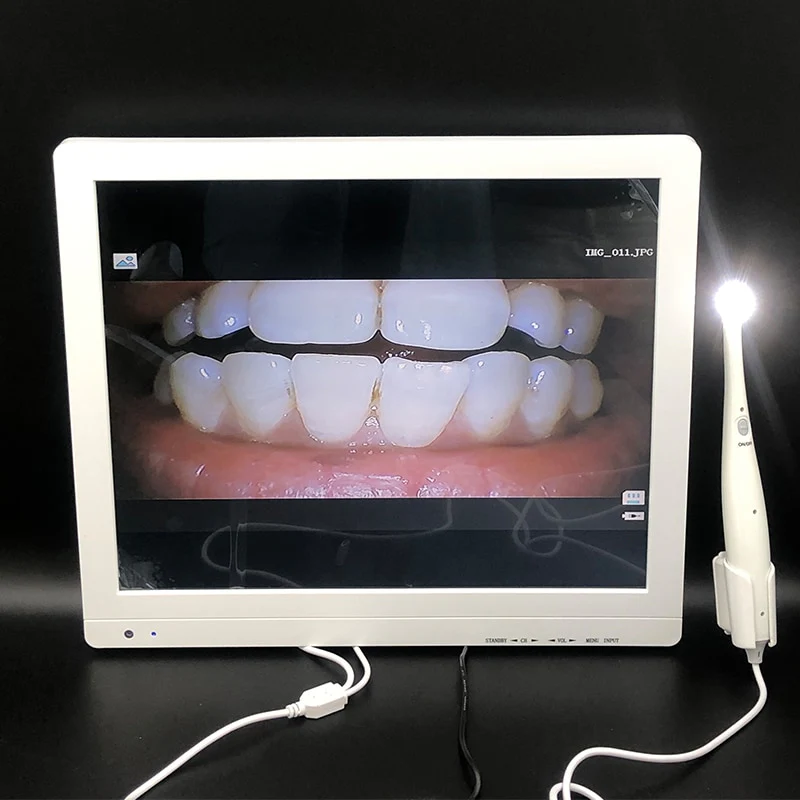 Intraoral Camera TV Dental Camera Intraoral Dentist Equipment Intraoral with High Resolution with 8 LED - Image 4