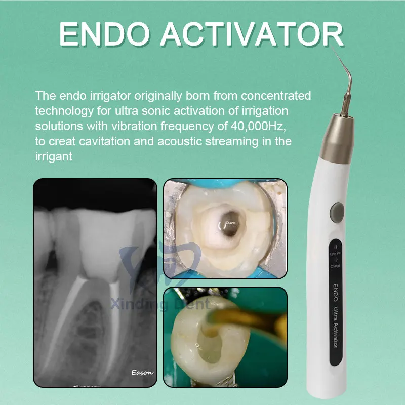 Dental Cordless LED Ultrasonic Activator Wireless Endo Ultra Activator For Endodontic Root Canal Irrigation Dentistry Tools - Image 3