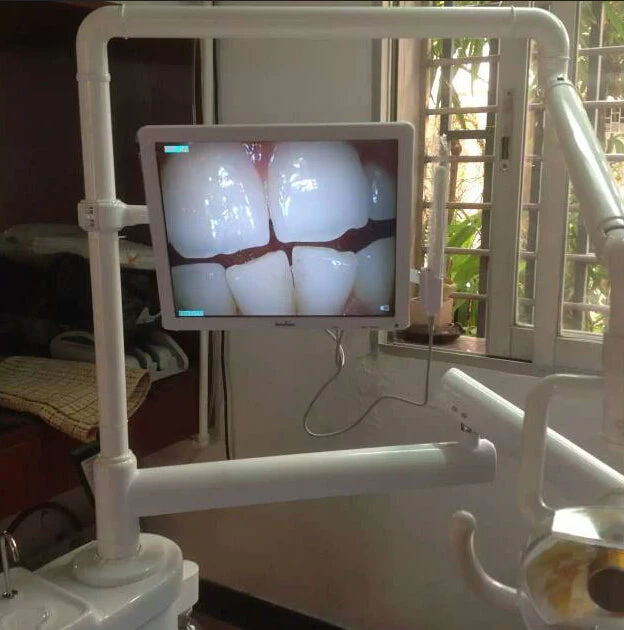 Dentist Intra Oral Camera Oral Dental USB Intraoral Camera Endoscope Photo Shoot - Image 2