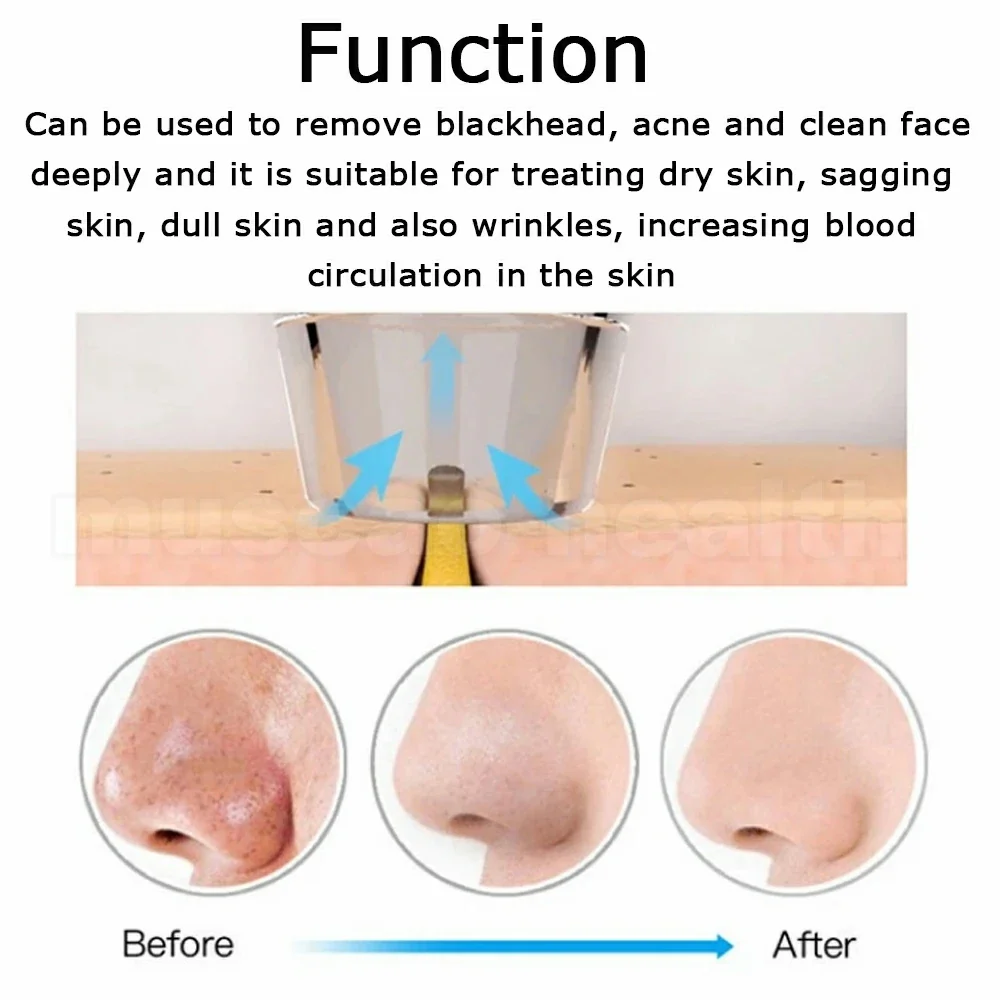Diamond Microdermabrasion Machine Remove Blackhead Wrinkle Facial Peeling Beauty Devices Suction Power Professional Dermabrasion - Image 3