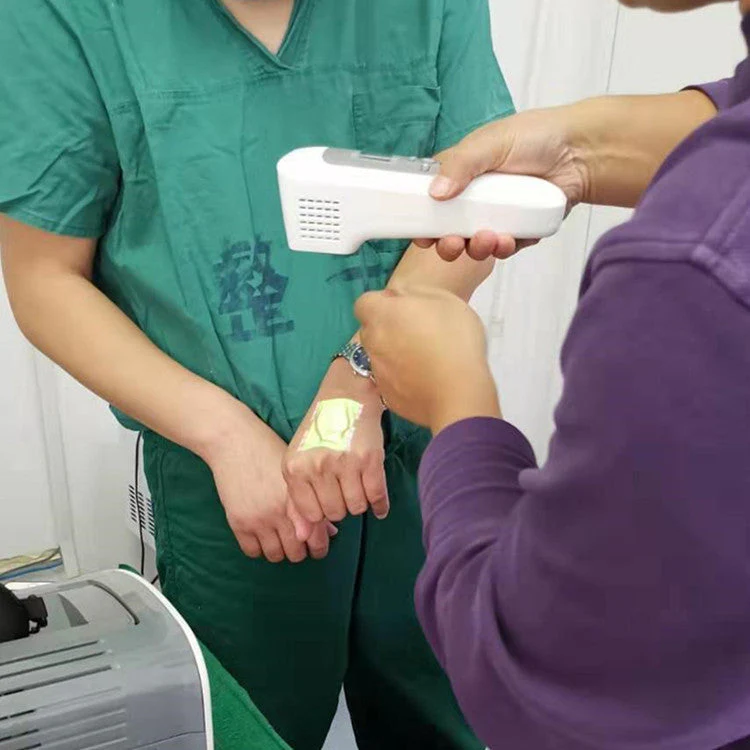 Digital Blood Vessel Imaging Portable Medical Vein Locator Detector Infrared Vein Finder Viewer - Image 4