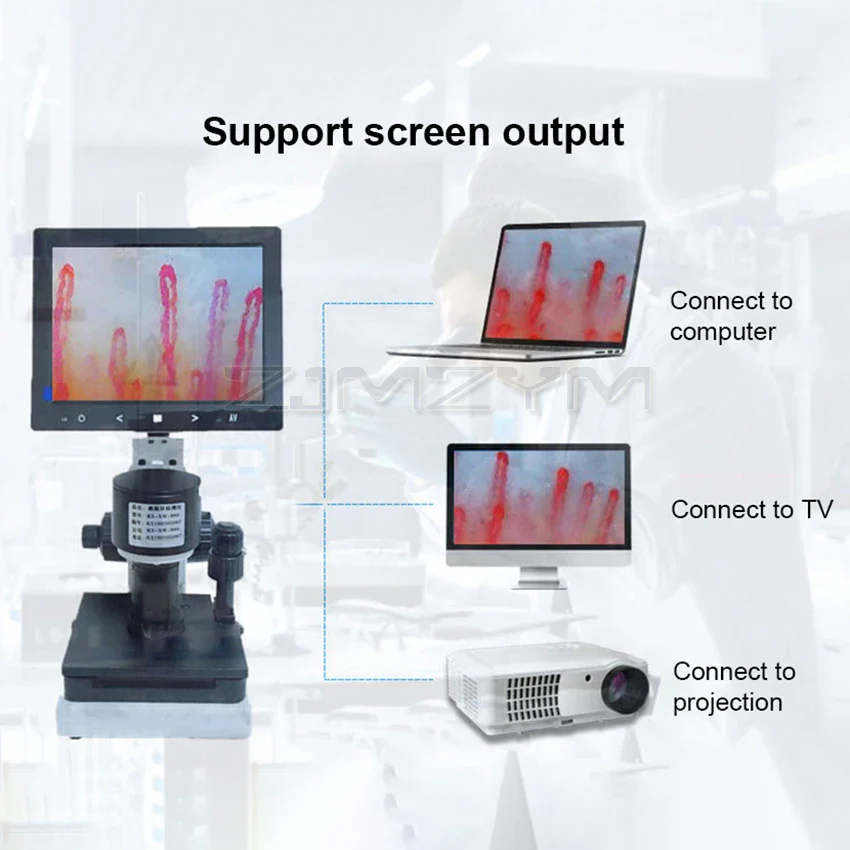 Digital Microscope Zoom Nailfold Capillary Microcirculation Detector Blood Microcirculation Analyzer with 7/8/9" Digital Screen - Image 6