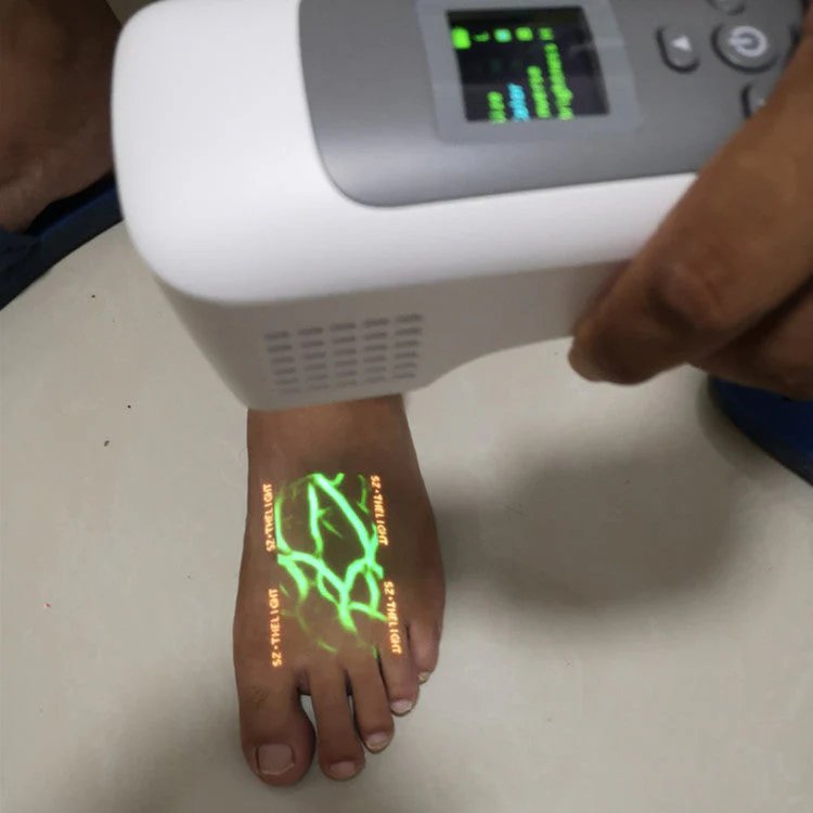 Digital Vein Finder Blood Vessel Imaging Portable Medical Vein Locator Detector - Image 5