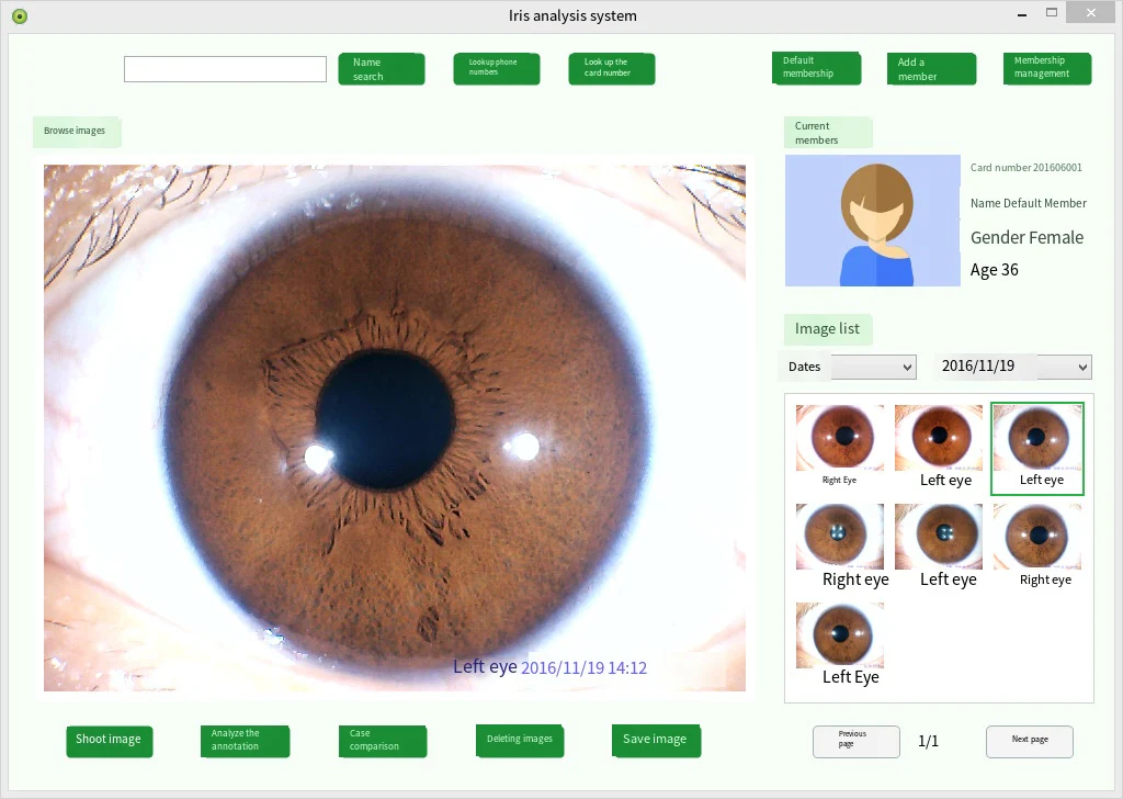 Digital Iridology Camera Iridology Analyzer Iris Analyzer Device Iris Diagnosis With Analysis Reports Customer Management System - Image 10