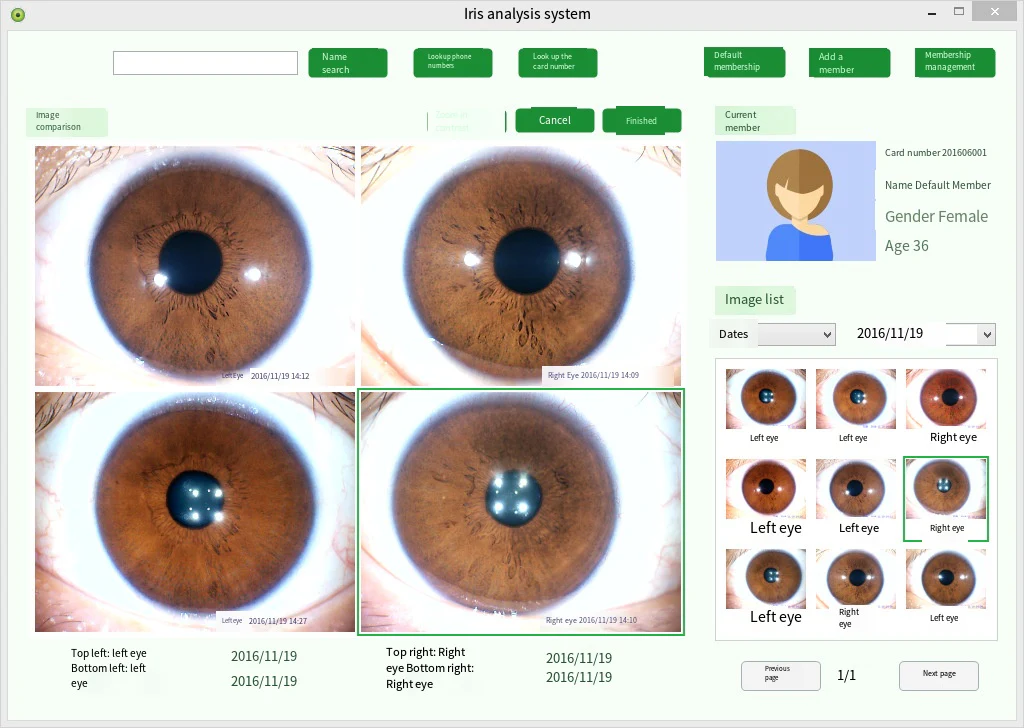 Digital Iridology Camera Iridology Analyzer Iris Analyzer Device Iris Diagnosis With Analysis Reports Customer Management System - Image 4