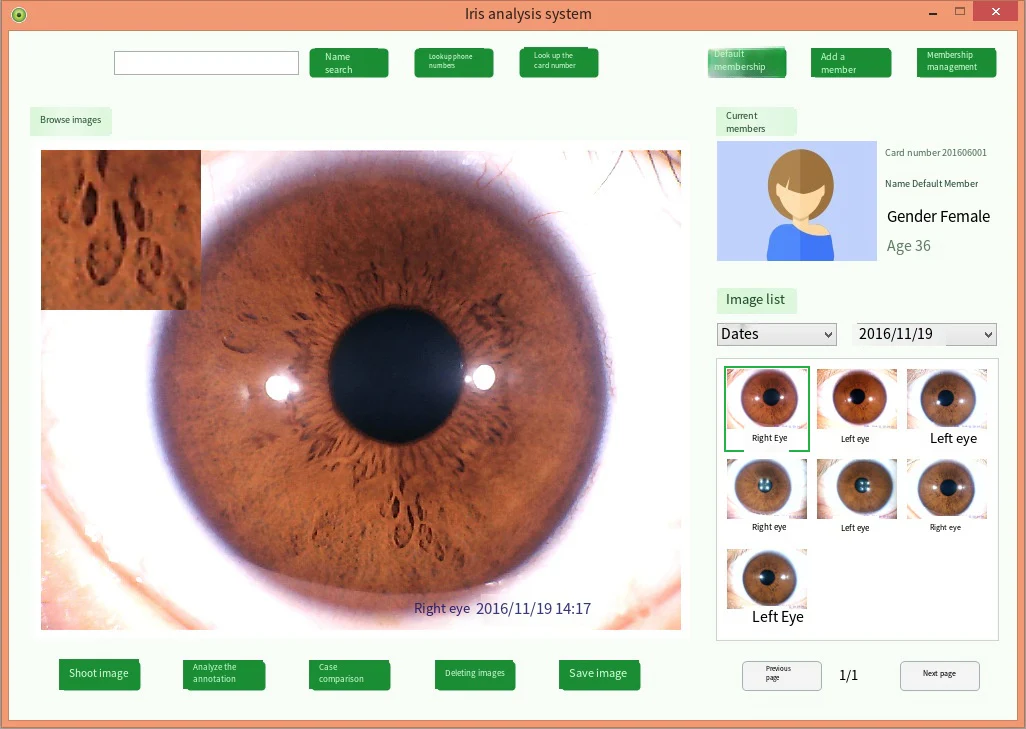 Digital Iridology Camera Iridology Analyzer Iris Analyzer Device Iris Diagnosis With Analysis Reports Customer Management System - Image 6