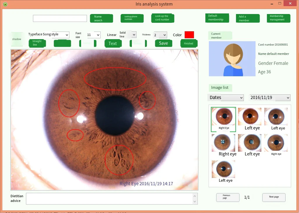 Digital Iridology Camera Iridology Analyzer Iris Analyzer Device Iris Diagnosis With Analysis Reports Customer Management System - Image 7