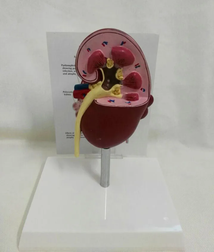 Dog Kidney Morbid Healthy Anatomical Model Canine Pet Teaching Aids Veterinary Medical Model - Image 2