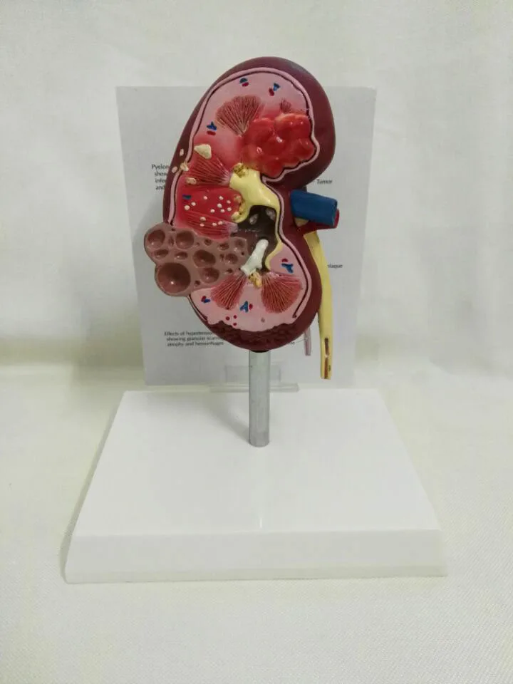 Dog Kidney Morbid Healthy Anatomical Model Canine Pet Teaching Aids Veterinary Medical Model - Image 3