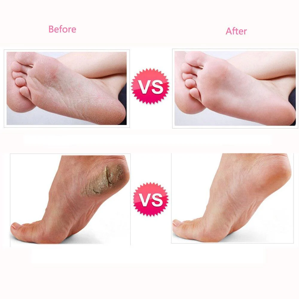Electric Callus Remover Electronic Foot File Hard Dead skin Polisher Exfoliating Grinding Feet Clean Care Tools Smooth Machine - Image 5