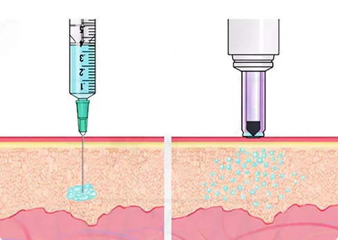 Electric Needle Free Injection System Needle Free Jet injector Gun - Image 8