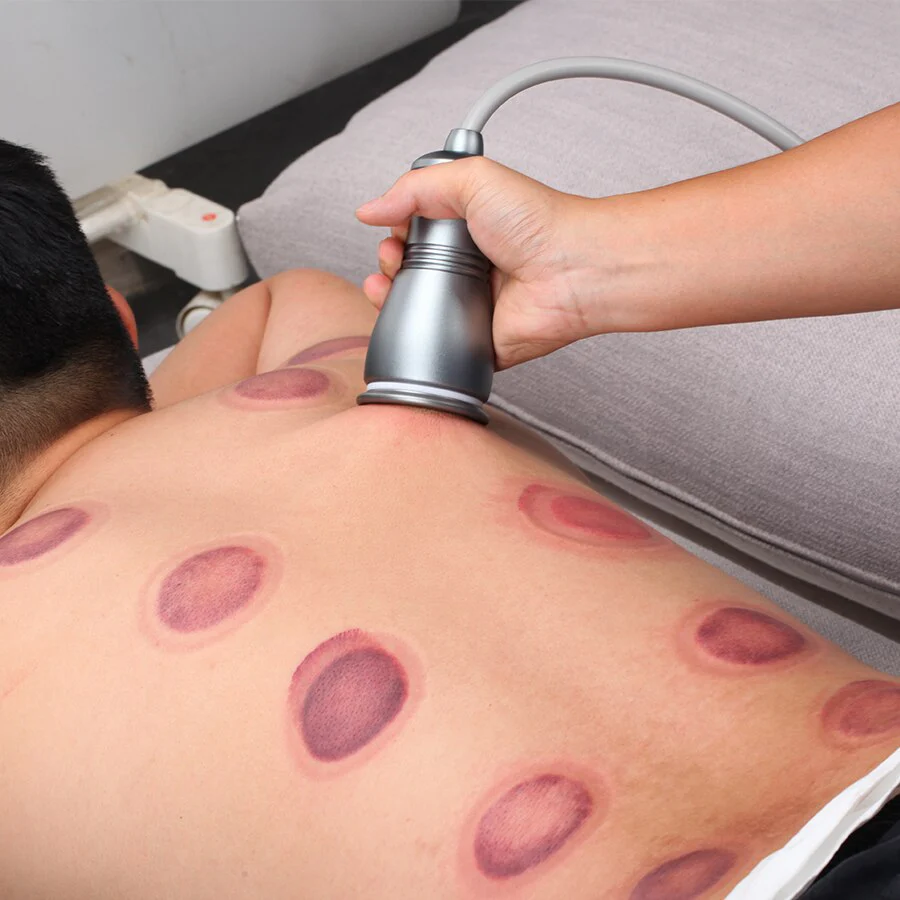 Electric Scraping Gua Sha Ventosas Anti Cellulite Fat Burner Cupping Body Slimming Massager Vibrating Meridian Dredge Guasha - Image 3