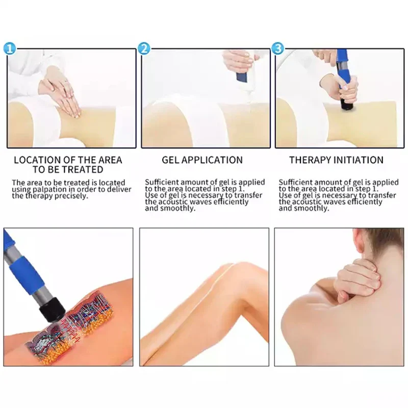 Electromagnetic Focused Shock Wave Therapy Machine With ED Treatment Pain Relief Extracorporeal Physiotherapy Shockwave Massager - Image 2