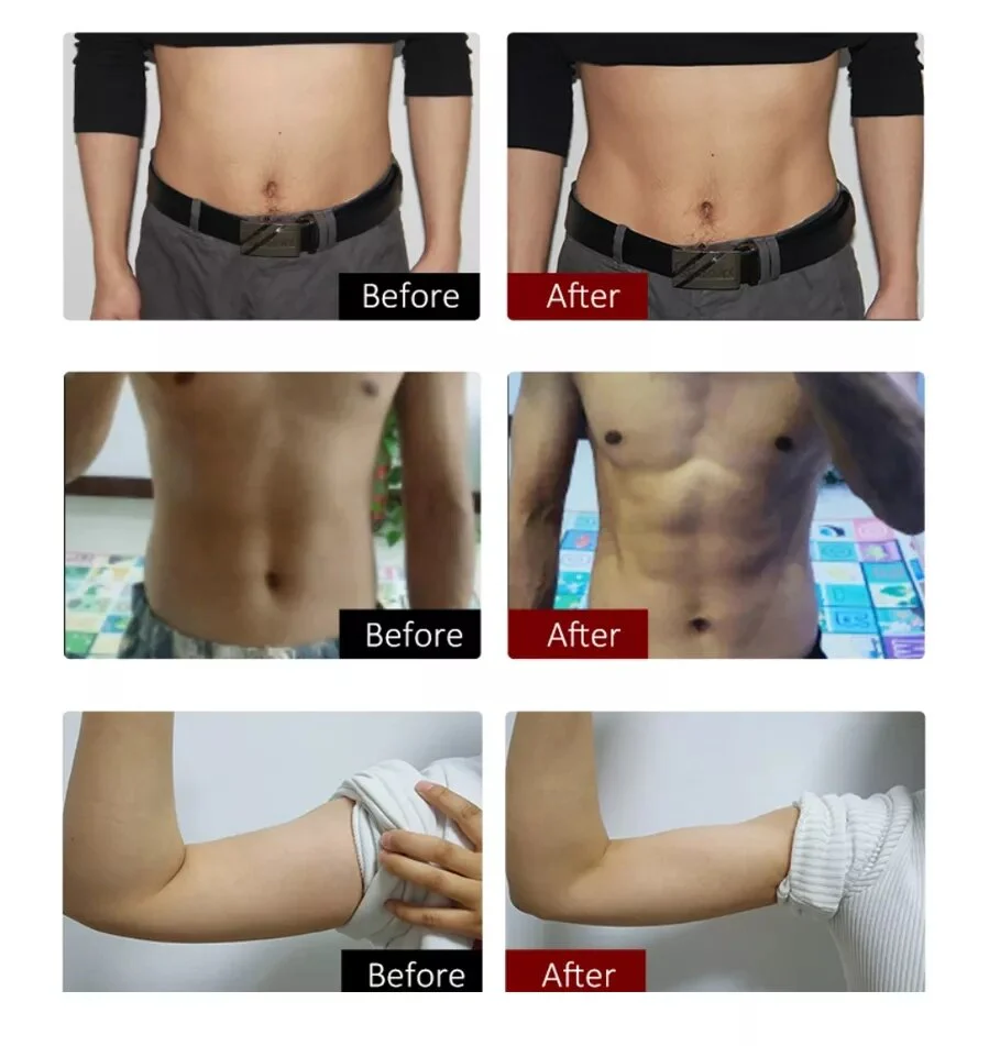 EMSlim Electromagnetic Slimming 14 Tesla Sculpting Machine EMS Muscle Lose Weight Stimulator for Butt Lift Fat Removal Salon Use - Image 4