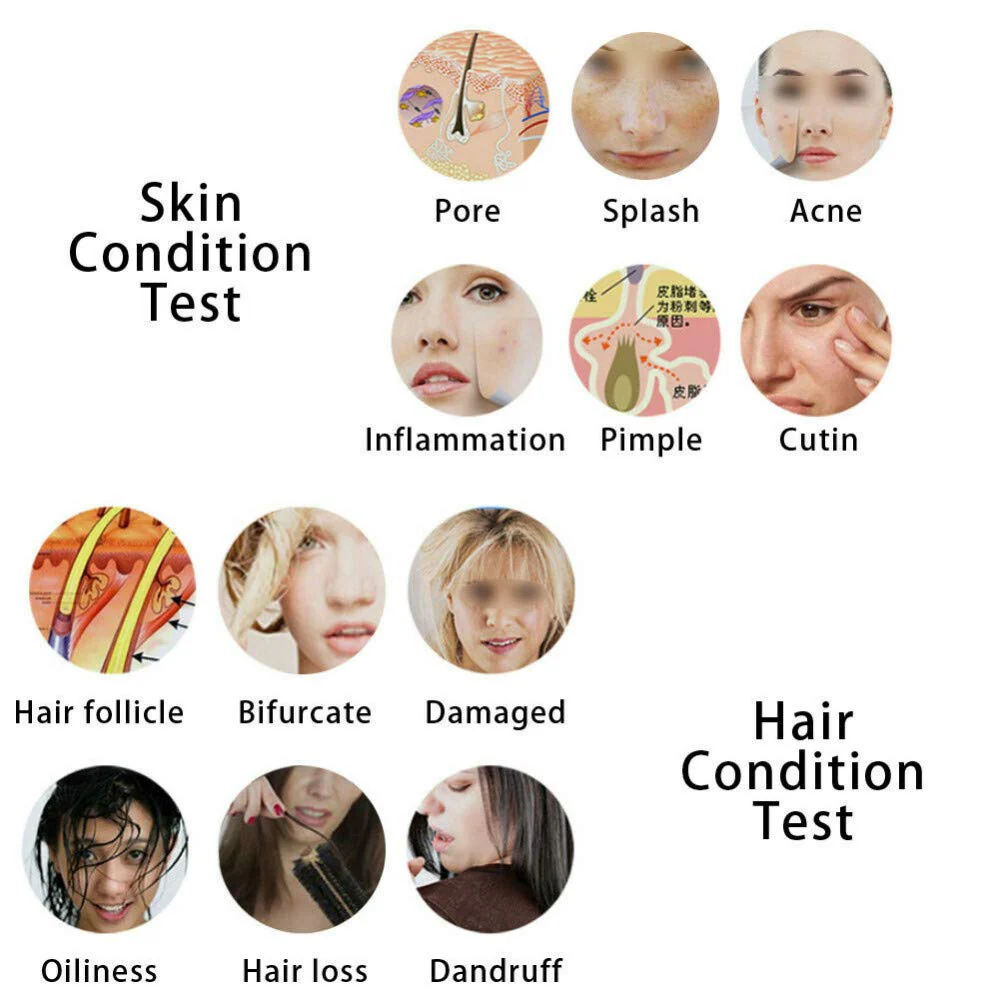 HD 200X 7 inches LCD Facial Skin Analyzer Hair Analyser Machine Digital Dermoscopy Skin Analysis Skin Detector - Image 5