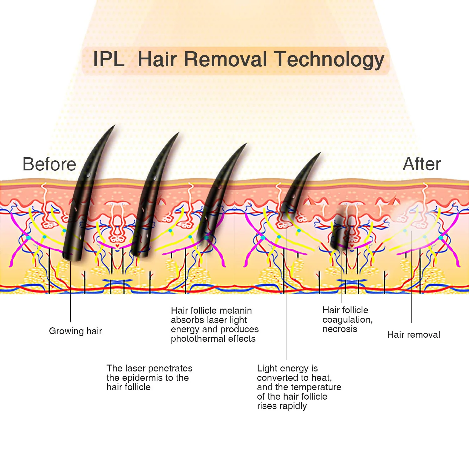 MiSMON MS-206B Laser Hair Removal For Women, IPL Hair Removal Device for Men/Women Permanent Results on Face and Body - Image 12