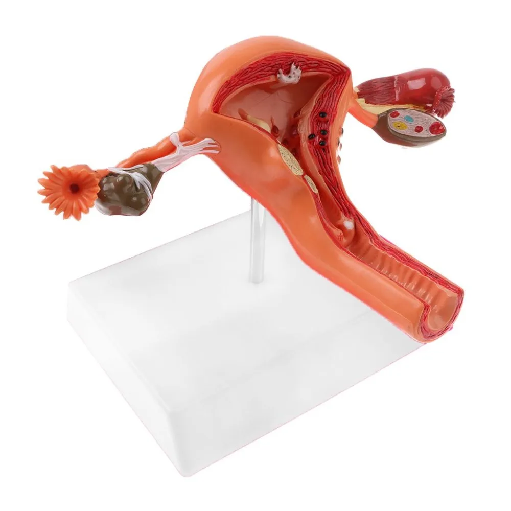 female Ovary and uterus disease Dissection model Pathology uterus model teaching human medical aids anatomy lesion uterus - Image 3