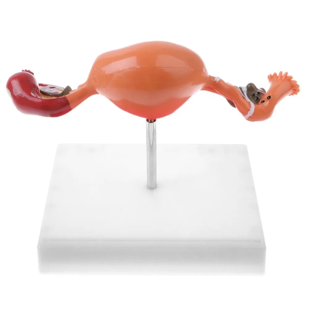 female Ovary and uterus disease Dissection model Pathology uterus model teaching human medical aids anatomy lesion uterus - Image 6
